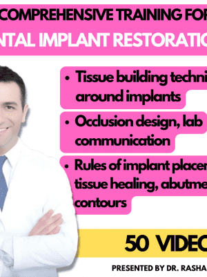 Implant Restorations Simplified: Restore Dental Implants with Accuracy & Confidence (Surgical Master)