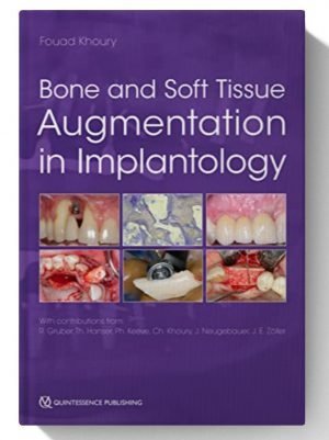 Bone and Soft Tissue Augmentation in Implantology