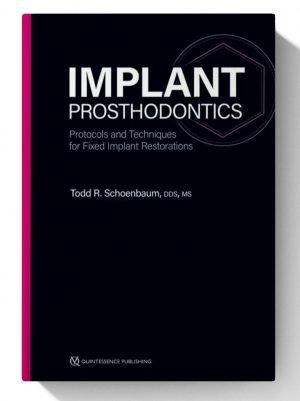 Implant Prosthodontics: Protocols and Techniques for Fixed Implant Restorations (Scanned)