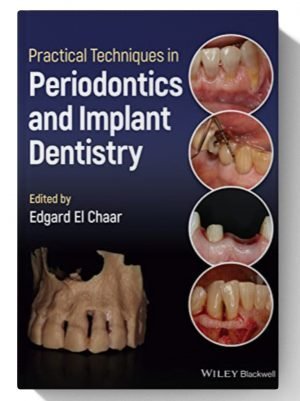 Practical Techniques in Periodontics and Implant Dentistry 1st Edition