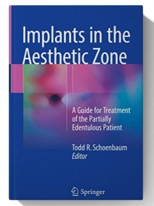 Implants in the Aesthetic Zone: A Guide for Treatment of the Partially Edentulous Patient 1st ed.