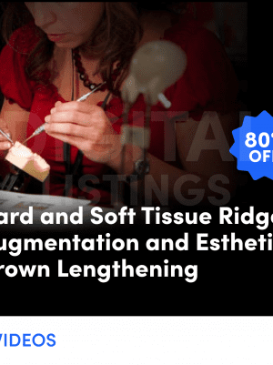 Hard and Soft Tissue Ridge Augmentation and Esthetic Crown Lengthening