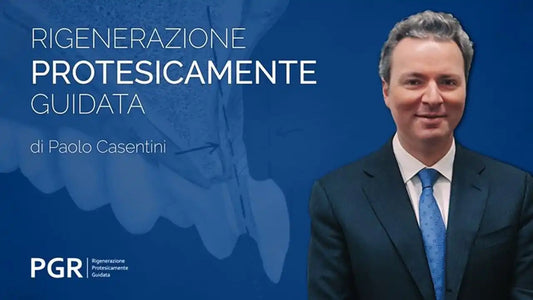 Rigenerazione Protesicamente Guidata: il nuovo modo di fare Rigenerazione che mette al centro il piano di trattamento protesico