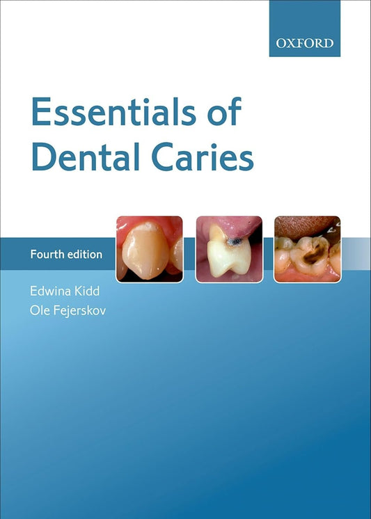 Essentials of Dental Caries