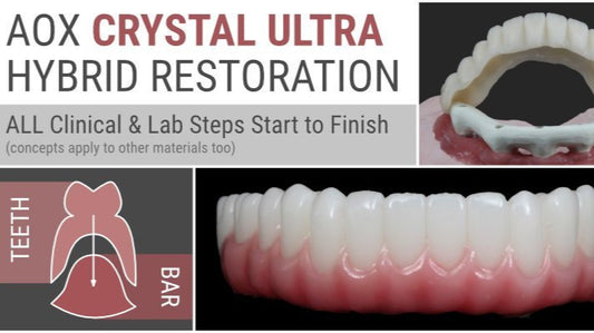 AOX Crystal Ultra Hybrid Restoration – ALL Clinical &amp; Lab Steps Start to Finish