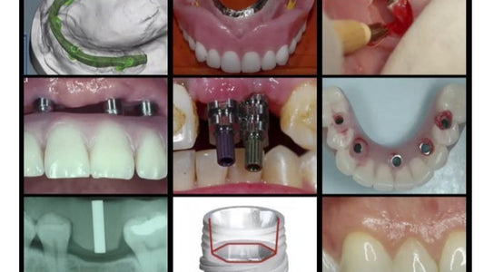 A-Z in Restorative Implant Dentistry Series (16 Lectures)