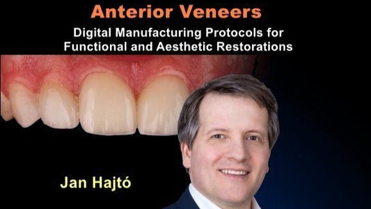 Anterior Veneers: Digital Manufacturing Protocols for Functional and Aesthetic Restorations