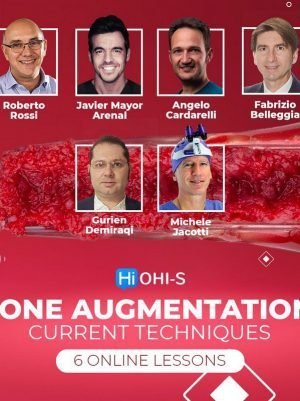Bone Augmentation: Current Techniques