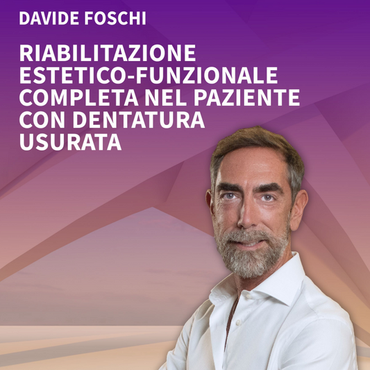 Riabilitazione estetico funzionale completa nel paziente con dentatura usurata