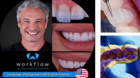 Ceramic Veneers Workflow