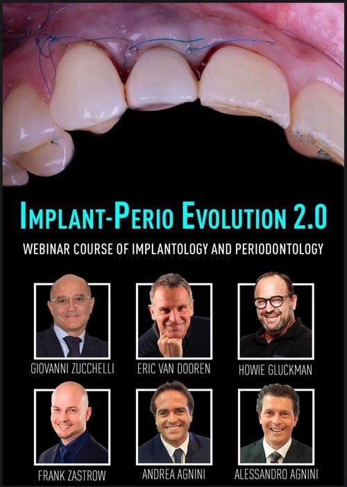 Implant Perio Evolution 2