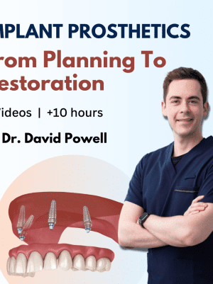 Implant Prosthetics: from Planning to Restoration