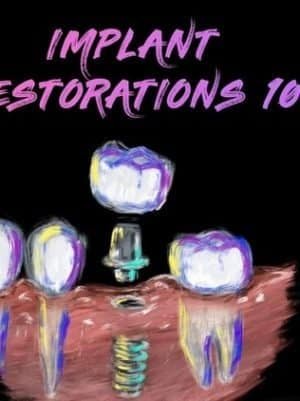 Implant Restorations 101