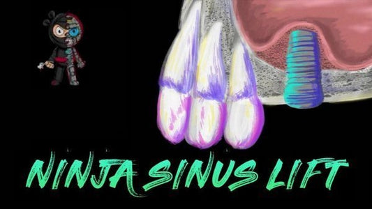 Ninja Sinus Lift Course