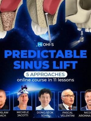 Predictable Sinus Lift Course