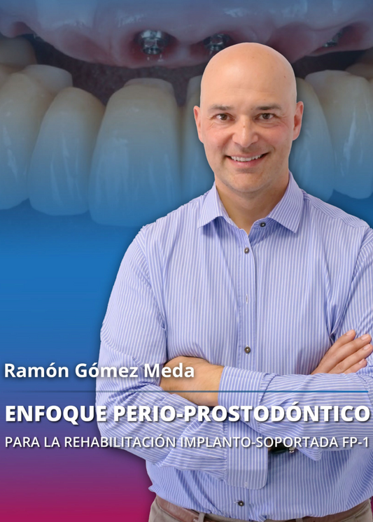 Enfoque perio prostodontico para la rehabilitacion implanto soportada FP 1