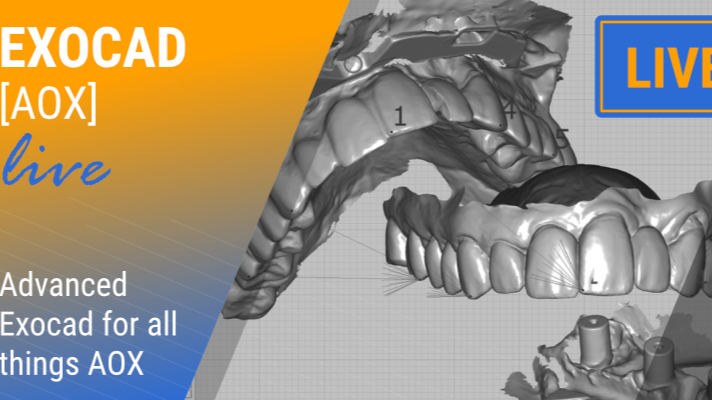Advanced EXOCAD for all things AOX (EXOCAD AOX)