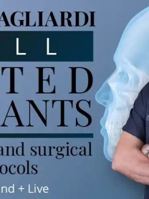 Full tilted implants: Prosthetic and Surgical protocols