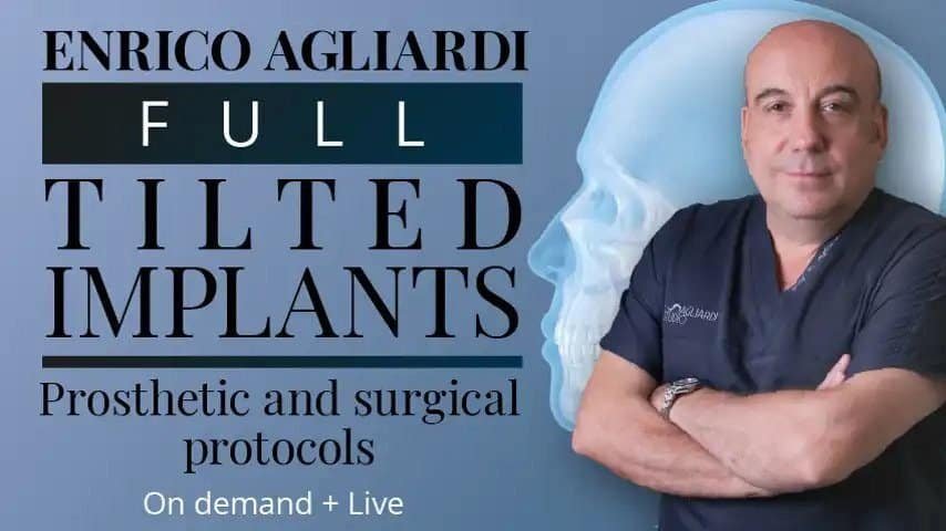 Full tilted implants: Prosthetic and Surgical protocols