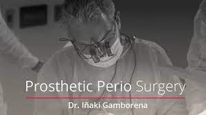 Prosthetic Perio Surgery