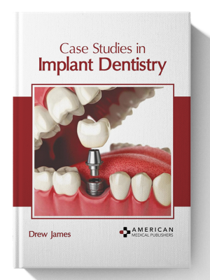 Case Studies in Implant Dentistry