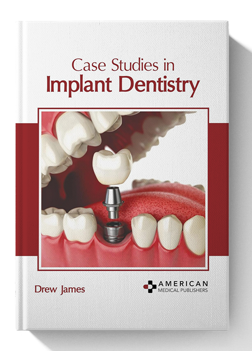 Case Studies in Implant Dentistry
