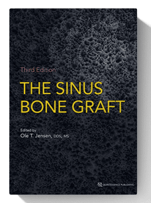 The Sinus Bone Graft, 3rd Edition 3rd Edition