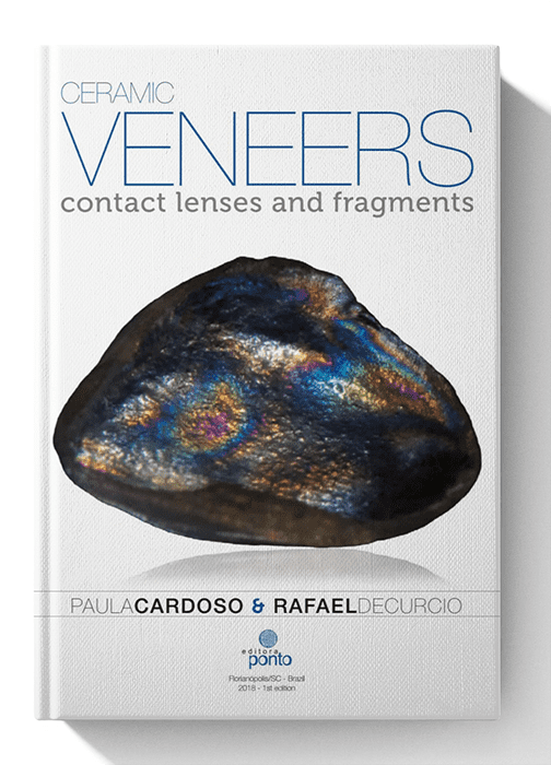 Ceramic Veneers Contact Lenses and Fragments