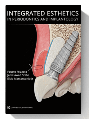 Integrated Esthetics in Periodontics and Implantology 1st Edition