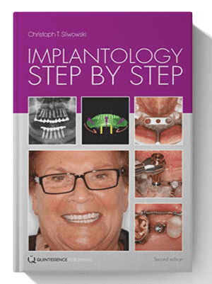 Implantology Step by Step 1st Edition