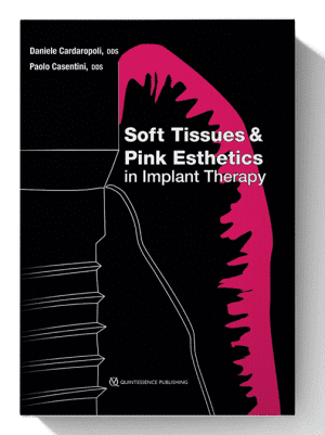 Soft Tissues and Pink Esthetics in Implant Therapy 1st Edition