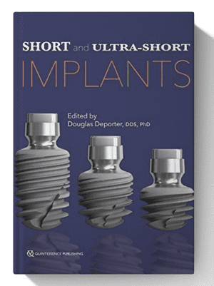 Short and Ultra-Short Implants 1st Edition