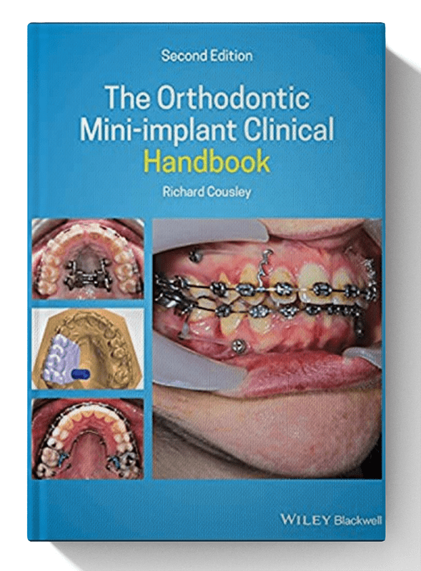 The Orthodontic Mini implant Clinical Handbook 2nd Edition