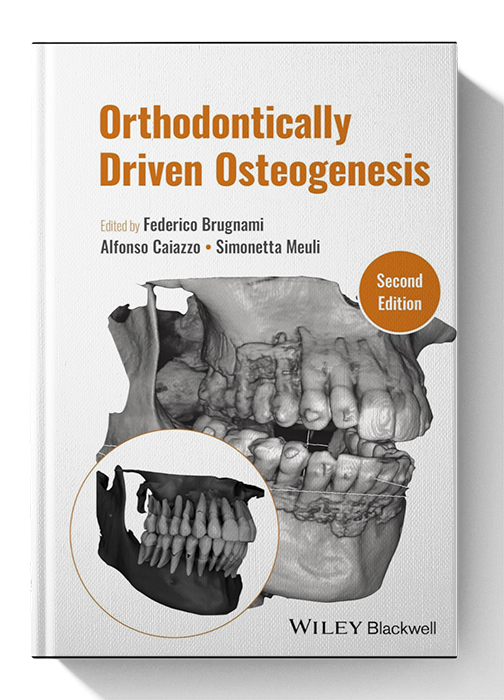 Orthodontically Driven Osteogenesis 2nd Edition