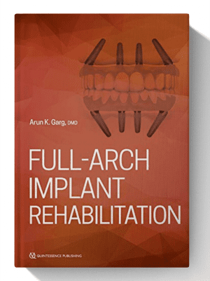Full-Arch Implant Rehabilitation 1st Edition