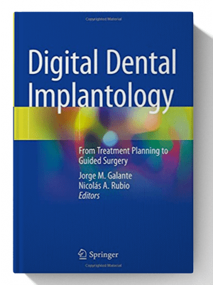 Digital Dental Implantology: From Treatment Planning to Guided Surgery 1st ed. 2021 Edition