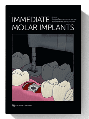Immediate Molar Implants