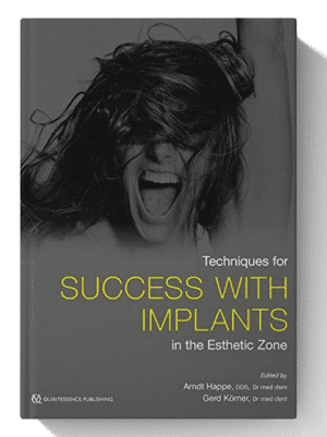Techniques for Success With Implants in the Esthetic Zone 1st Edition