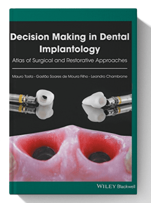 Decision Making in Dental Implantology: Atlas of Surgical and Restorative Approaches 1st Edition