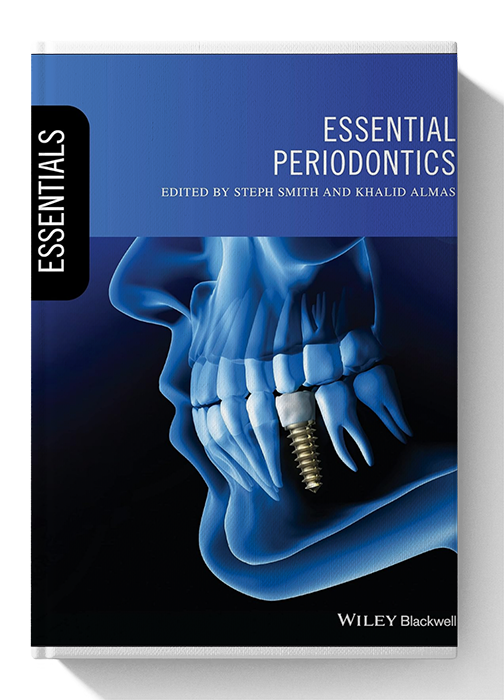 Essential Periodontics (Essentials (Dentistry)) 1st Edition