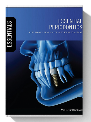 Essential Periodontics (Essentials (Dentistry)) 1st Edition