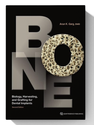 Bone: Biology, Harvesting, and Grafting for Dental Implants 2nd Edition