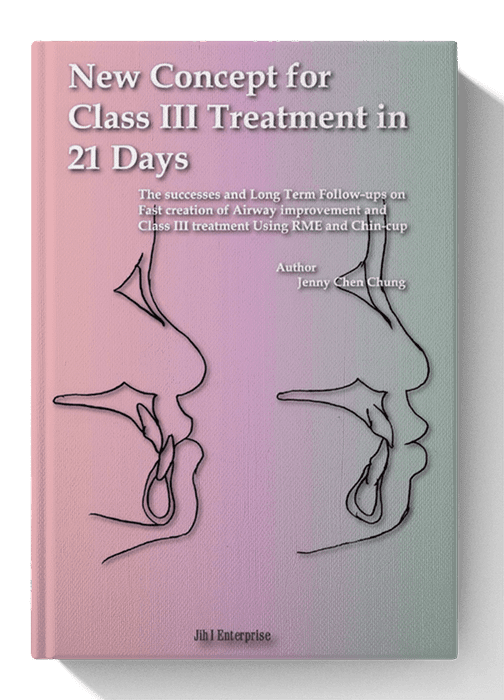 New Concept for Class III Treatment in 21 Days