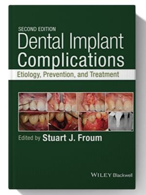 Dental Implant Complications: Etiology, Prevention, and Treatment 2nd Edition