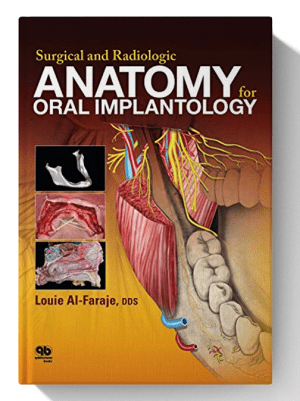 Surgical and Radiologic Anatomy of Oral Implantology 1st edition