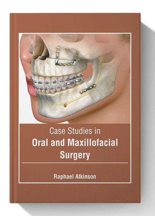Case Studies in Oral and Maxillofacial Surgery