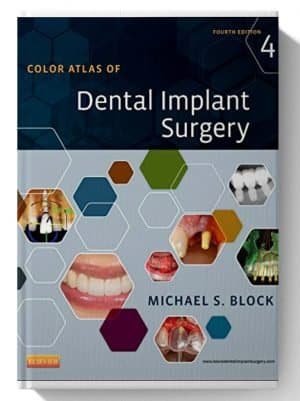 Color Atlas of Dental Implant Surgery 4th Edition