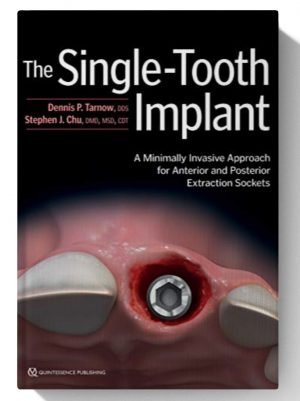 The Single-Tooth Implant: A Minimally Invasive Approach for Anterior and Posterior Extraction Sockets 1st Edition