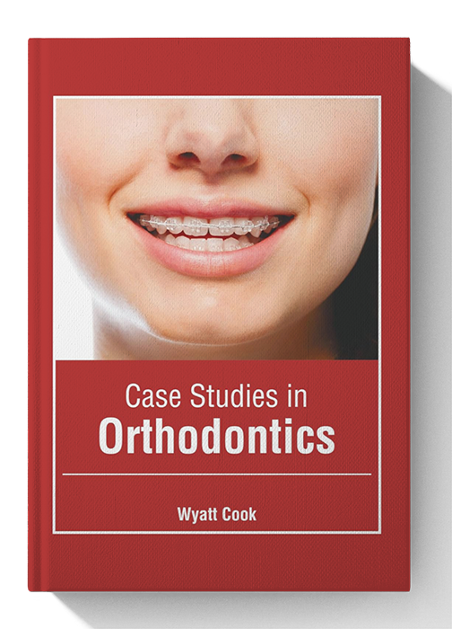Case Studies in Orthodontics