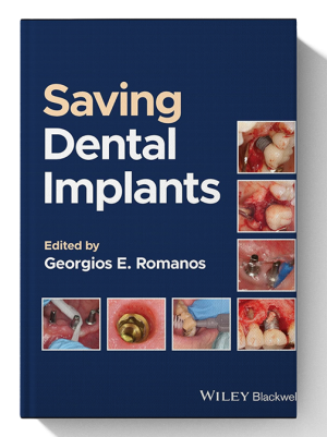Saving Dental Implants 1st Edition